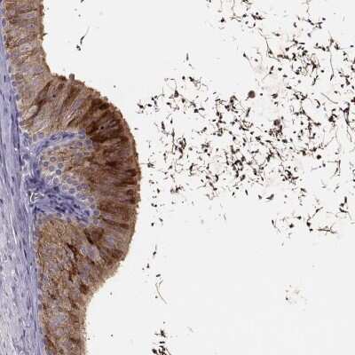 Immunohistochemistry-Paraffin: WFDC8 Antibody [NBP2-62671]