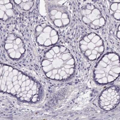 Immunohistochemistry-Paraffin: WFDC8 Antibody [NBP2-62671]