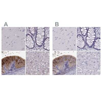 Immunohistochemistry-Paraffin: WFDC8 Antibody [NBP2-62671]