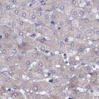 Immunohistochemistry-Paraffin: WFDC8 Antibody [NBP2-62671]