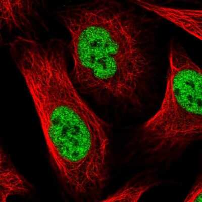 Immunocytochemistry/ Immunofluorescence: WHIP Antibody [NBP2-38190]