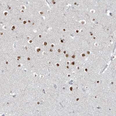 Immunohistochemistry-Paraffin: WHIP Antibody [NBP1-90030]