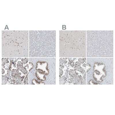 Immunohistochemistry-Paraffin: WHIP Antibody [NBP1-90030]
