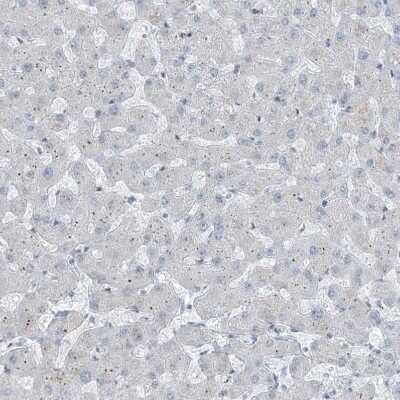 Immunohistochemistry-Paraffin: WHIP Antibody [NBP1-90030]