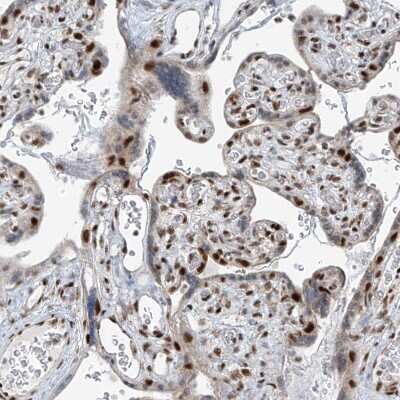 Immunohistochemistry-Paraffin: WHIP Antibody [NBP1-90030]