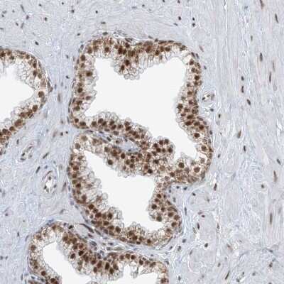 Immunohistochemistry-Paraffin: WHIP Antibody [NBP1-90030]
