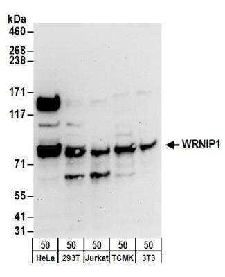 Western Blot: WHIP Antibody [NB110-61626]