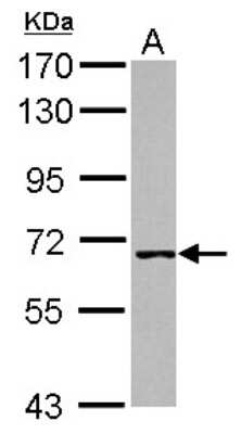 Western Blot: WHIP Antibody [NBP2-20905]