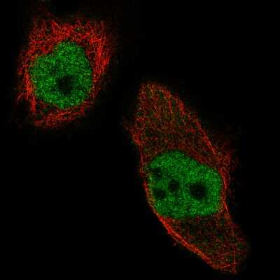 Immunocytochemistry/ Immunofluorescence: WHSC1 Antibody (CL1057) [NBP2-52962]