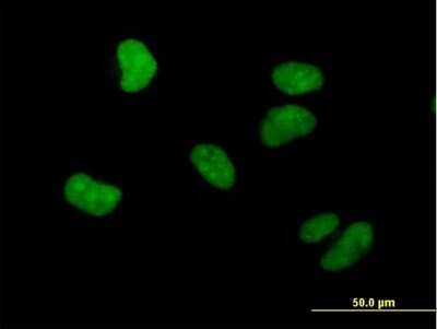 Immunocytochemistry/ Immunofluorescence: WHSC1 Antibody [H00007468-B01P]