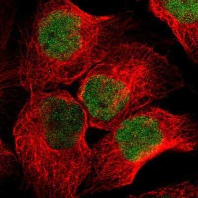 Immunocytochemistry/ Immunofluorescence: WHSC1 Antibody [NBP1-82633]