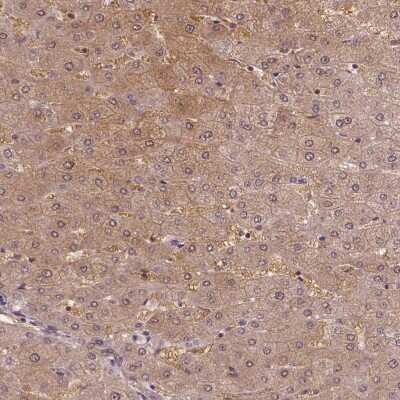 Immunohistochemistry-Paraffin: WHSC1 Antibody [NBP1-82633]