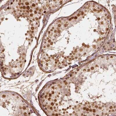 Immunohistochemistry-Paraffin: WHSC1 Antibody [NBP1-82633]