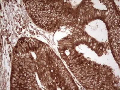 Immunohistochemistry: WIBG Antibody (OTI5E2) [NBP2-46366]