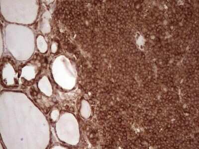 Immunohistochemistry: WIBG Antibody (OTI5E2) [NBP2-46366]