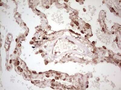 Immunohistochemistry: WIBG Antibody (OTI5E2) - Azide and BSA Free [NBP2-74868]