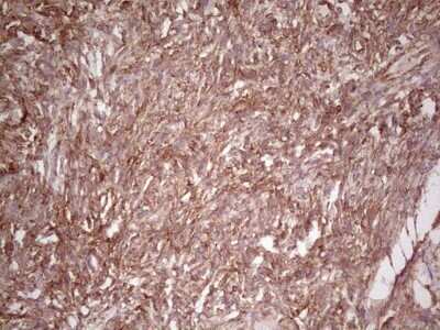 Immunohistochemistry: WIBG Antibody (OTI5E2) - Azide and BSA Free [NBP2-74868]