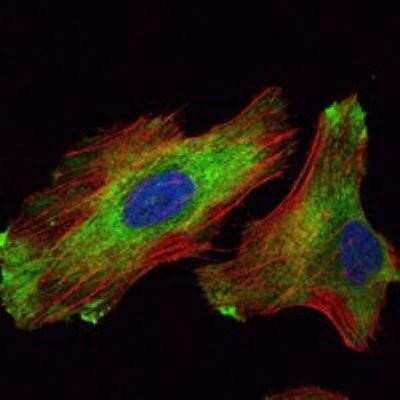 Immunocytochemistry/ Immunofluorescence: WIF-1 Antibody (1G5) - BSA Free [NBP1-51658]