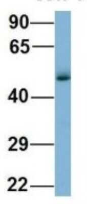 Western Blot: WIPI1 Antibody [NBP1-56874]