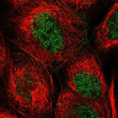 Immunocytochemistry/ Immunofluorescence: WIPI2 Antibody [NBP1-88880]