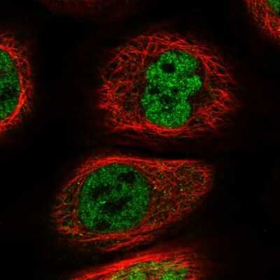 Immunocytochemistry/ Immunofluorescence: WIRE Antibody [NBP1-86857]