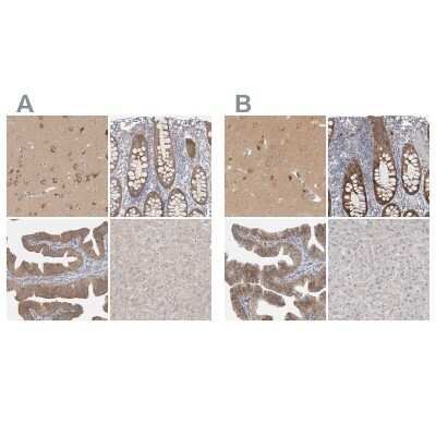 Immunohistochemistry-Paraffin: WIRE Antibody [NBP1-86856]