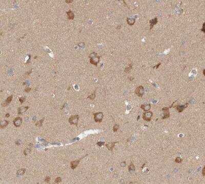 Immunohistochemistry-Paraffin: WIRE Antibody [NBP1-86856]