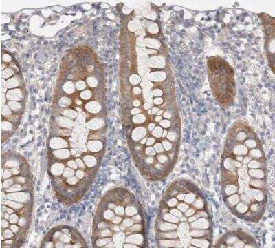 Immunohistochemistry-Paraffin: WIRE Antibody [NBP1-86856]