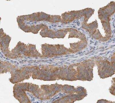 Immunohistochemistry-Paraffin: WIRE Antibody [NBP1-86856]