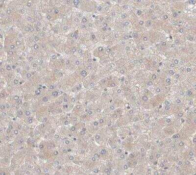 Immunohistochemistry-Paraffin: WIRE Antibody [NBP1-86856]