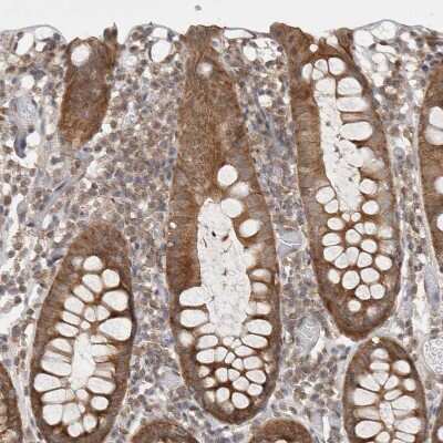 Immunohistochemistry-Paraffin: WIRE Antibody [NBP1-86857]