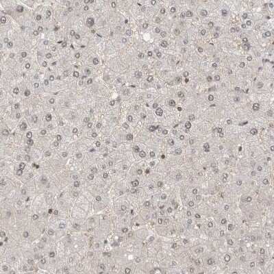 Immunohistochemistry-Paraffin: WIRE Antibody [NBP1-86857]