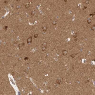 Immunohistochemistry-Paraffin: WIRE Antibody [NBP1-86857]