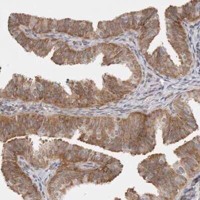 Immunohistochemistry-Paraffin: WIRE Antibody [NBP1-86857]