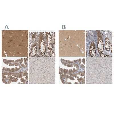 Immunohistochemistry-Paraffin: WIRE Antibody [NBP1-86857]