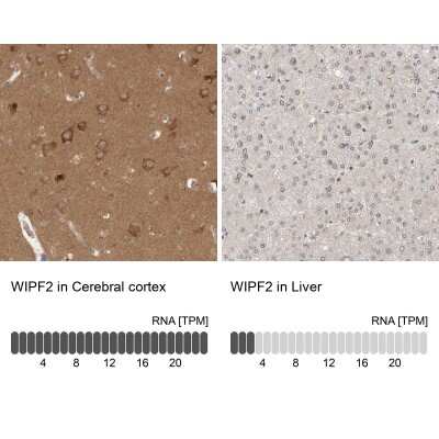Immunohistochemistry-Paraffin: WIRE Antibody [NBP1-86857]