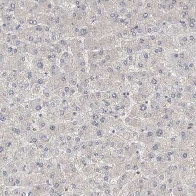 Immunohistochemistry-Paraffin: WIRE Antibody [NBP1-86858]