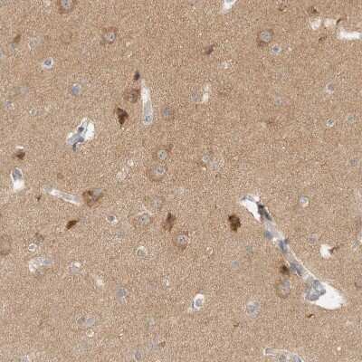 Immunohistochemistry-Paraffin: WIRE Antibody [NBP1-86858]