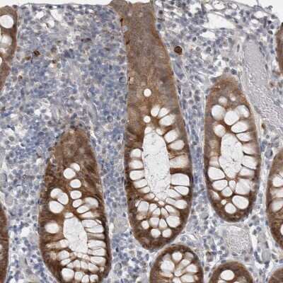 Immunohistochemistry-Paraffin: WIRE Antibody [NBP1-86858]