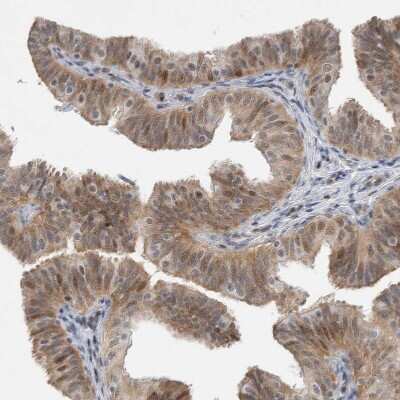 Immunohistochemistry-Paraffin: WIRE Antibody [NBP1-86858]