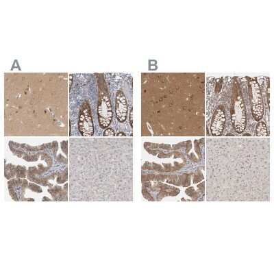 Immunohistochemistry-Paraffin: WIRE Antibody [NBP1-86858]
