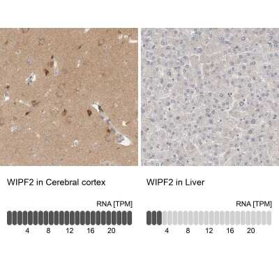 Immunohistochemistry-Paraffin: WIRE Antibody [NBP1-86858]