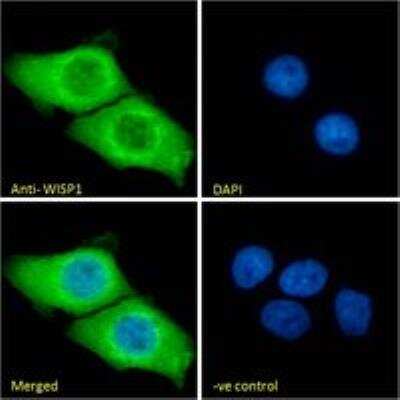 Immunocytochemistry/ Immunofluorescence: WISP-1/CCN4 Antibody [NB100-77339]