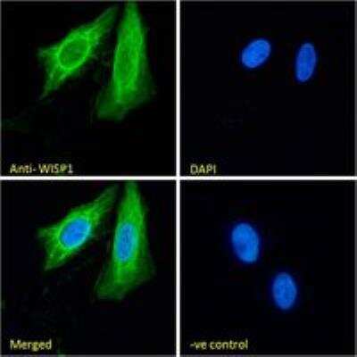 Immunocytochemistry/ Immunofluorescence: WISP-1/CCN4 Antibody [NB100-77339]