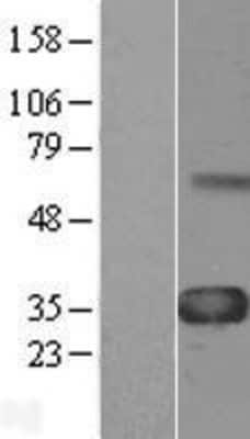 Western Blot: WISP-1/CCN4 Overexpression Lysate [NBL1-17856]