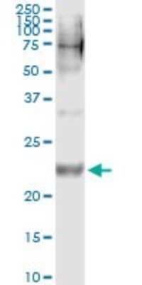 Immunoprecipitation: WISP2 Antibody (3D10) [H00008839-M09]