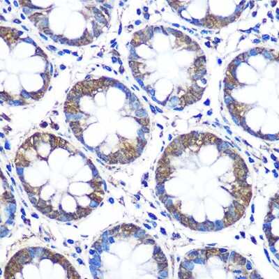 Immunohistochemistry-Paraffin: WISP2 Antibody - Azide and BSA Free [NBP2-93612]