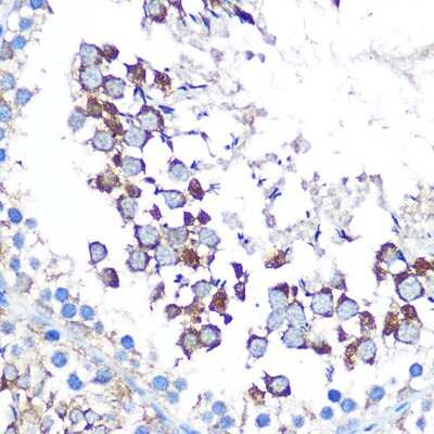 Immunohistochemistry-Paraffin: WISP2 Antibody - Azide and BSA Free [NBP2-93612]