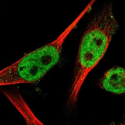 Immunocytochemistry/ Immunofluorescence: WIZ Antibody [NBP1-80586]