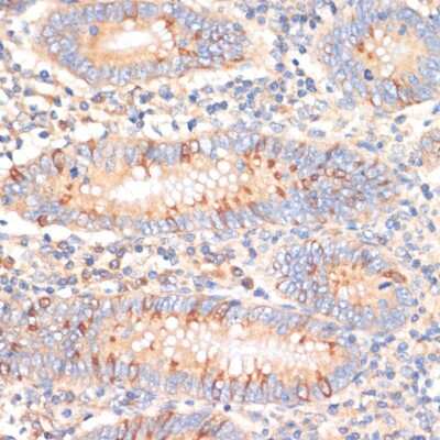 Immunohistochemistry-Paraffin: WNK3 Antibody - BSA Free [NBP2-94269]